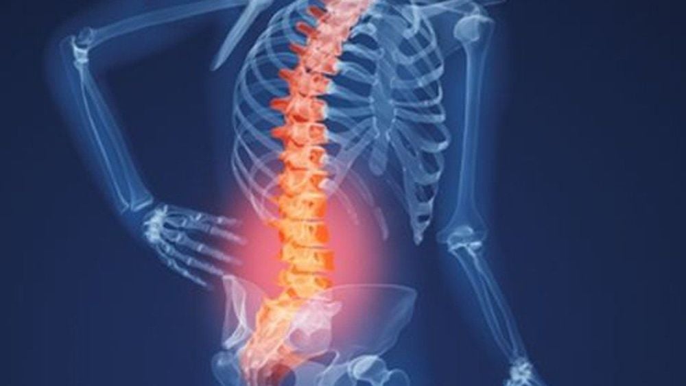 Đau lưng dưới: Nguyên nhân, điều trị
